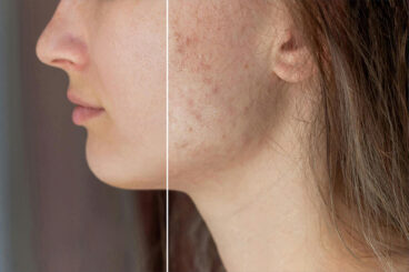 30+ Best Skin Retouching & Smoothing Photoshop Actions
